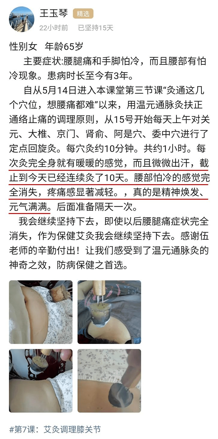 中医艾灸，健康改善的有效手段