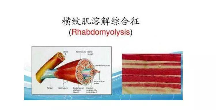 教育局回应男孩被体罚致横纹肌溶解，坚决维护学生权益，确保教育安全