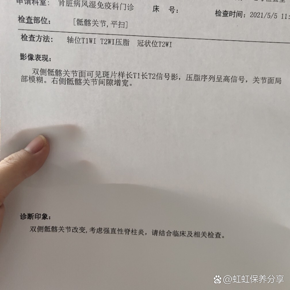 强直性脊柱炎患者求职遭遇的困境与挑战，入职被拒现象探讨