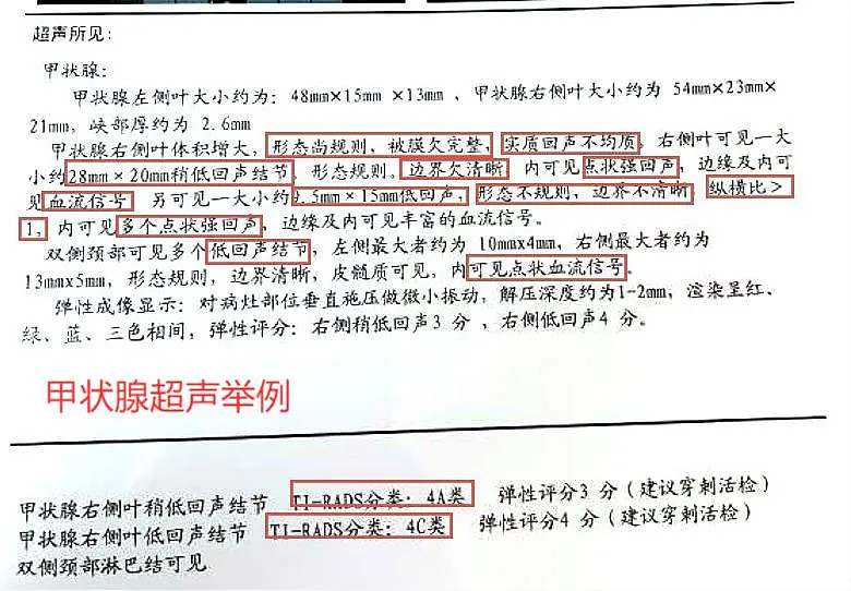 两岁男童甲状腺结节四级，勇敢面对，家庭共同抗击病魔